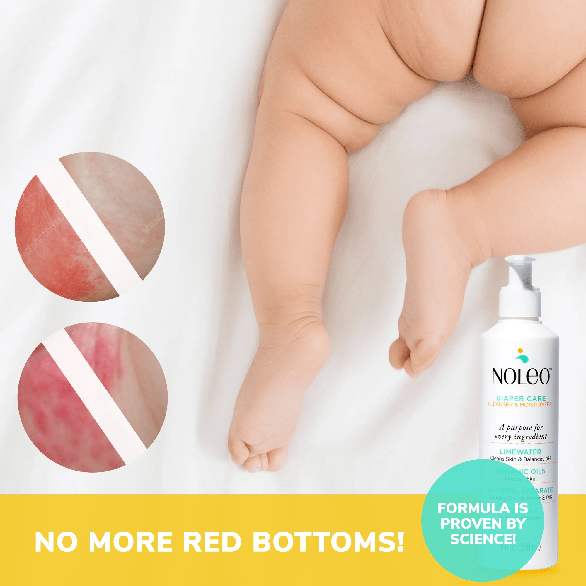 NOLEO 3-IN-1 (Pack of 6)